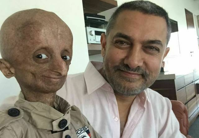 nihal_progeria